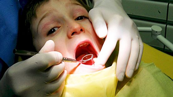 Pyörtyminenkään ei ole tavatonta hammaslääkärin vastaanotolla.