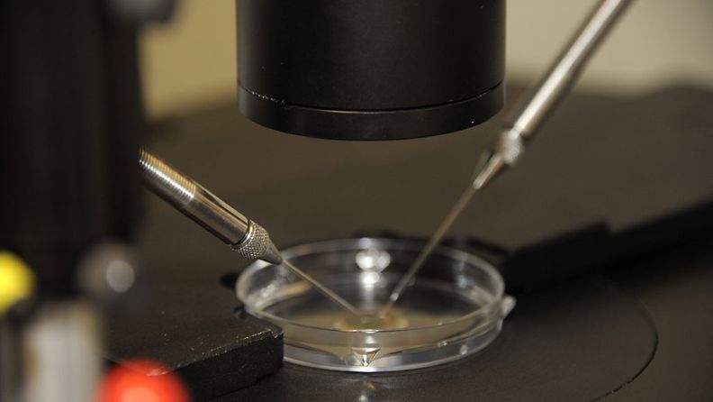 Lähikuva mikroskooppityökalusta, jolla yhdistetään munasolu ja siittiö Felicitas-klinikalla.