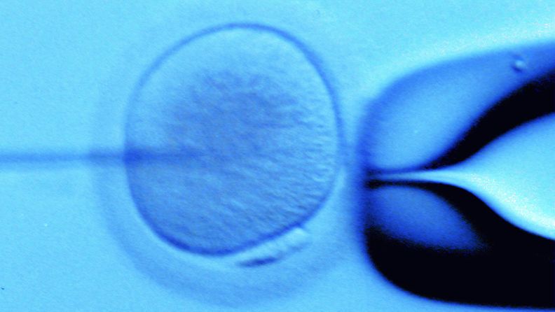 Kuva otettu Naistenklinikan biologi Christel Hyden-Granskogin käänteismikroskoopilla. Oikealla lasiputki, jonka päässä munasolua pidetään alipaineella paikallaan. Vasemmalla neula, jolla siittiö mikrohedelmöityksessä tuodaan keskellä olevaan munasoluun. 
