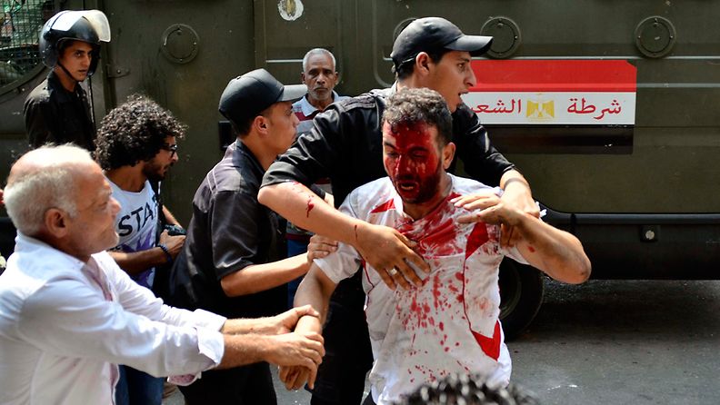 Loukkaantunut mies Mursin kannattajien ja vastustajien välisessä yhteenotossa 13.8.2013.
