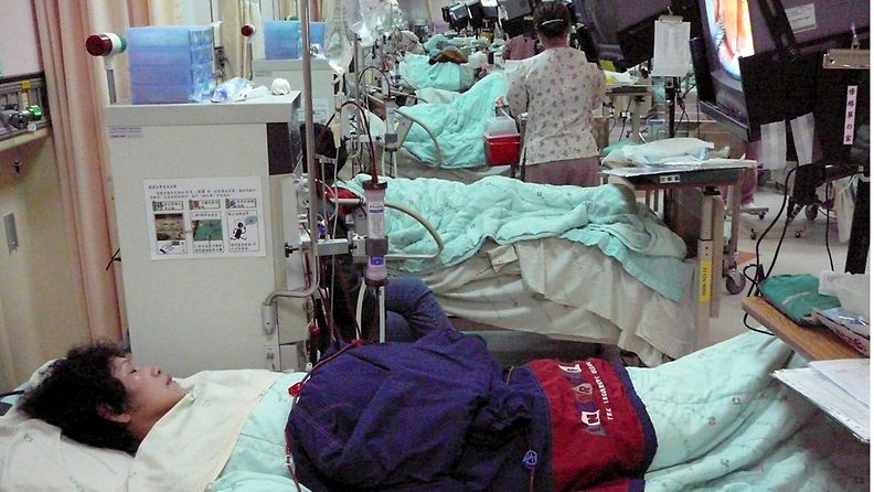 Kiinassa on noin 1,5 miljoonaa elinsiirron tarpeessa olevaa potilasta joka vuosi.