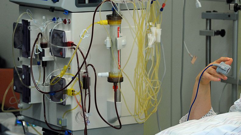 E.coli-bakteeriin sairastuntu nainen on hoidettavana hampurilaisessa sairaalassa 30.5.2011.