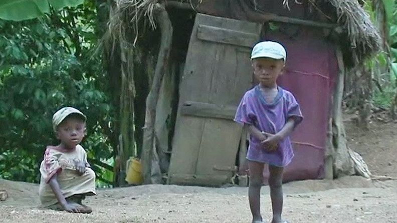 Lasten aliravitsemus on alati kasvava ongelma Haitissa.