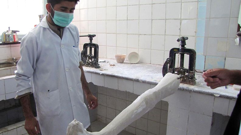 An Afghan worker works at an artificial limb during a program for disabled, support by International Committee of the Red Cross (ICRC) in Jalalabad, 10 July 2012. Reports state that ICRC in 2002 shows that 400,460 persons visited ICRC offices in that year and it saw 703807 patients seeking help. In 2002, the ICRC was able to visit 448,063 detainees, in 2011, they visited 540,828. During that same time the number of surgical operations rose from 90,361 to 138,200.