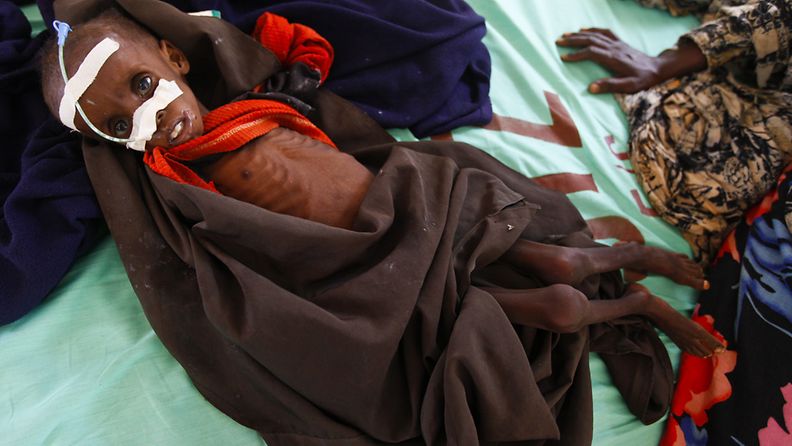 Two-year-old severely malnourished Somali refugee boy Fariyo Yusuf lays on a bed with his mother at the Ifo camp, one of three camps that make up sprawling Dadaab refugee camp, in Dadaab, northeastern Kenya, on 02 August 2011.