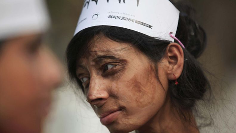 Monira, a survivor of an acid attack, takes part in an awareness rally about the violence against women as they commemorate International Women's Day in Dhaka March 8, 2012. LEHTIKUVA / REUTERS/Andrew Biraj (BANGLADESH 
