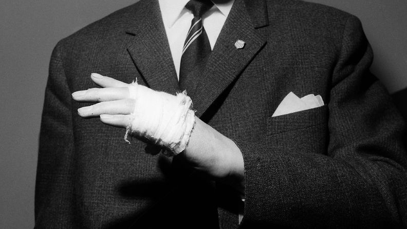 Pertti "Purtsi" Purhosen vasen käsi 12.4 1961. Purtsilla on kädessään ajos, joka on siteessä.