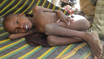 Pitkä kävelymatka pakolaisleirille uuvuttaa varsinkin lapset. Tämä pikkupoika pakeni kotikylänsä kuivuutta Kenian pakolaisleirille kesäkuussa. Kuva: EPA