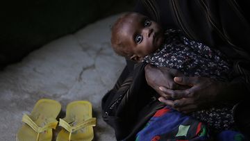 Pakolaisleirin katastrofaalisesta tilanteesta huolimatta perheillä on edes pieni mahdollisuus saada apua sairaille, nälkäisille lapsilleen. Kuvassa äiti aliravitun lapsensa kanssa Dadaabin pakolaisleirillä Keniassa 17.7.2011