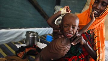 Äidin tuska lapsen hädän edessä. Somaliäiti hoitaa pientä aliravittua poikaansa kesäkuussa. Kuva: EPA