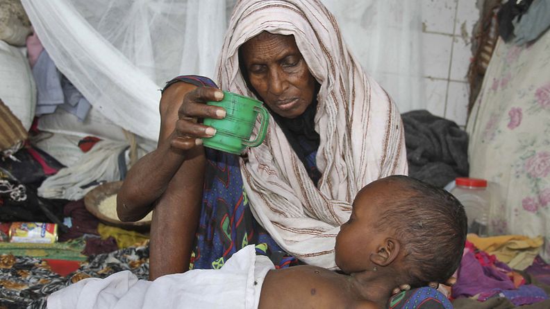 Somaliäiti hoitaa pahasti aliravittua lastaan Mogadishussa 19.7.2011. Kuivuus on ajanut perheet pois kodeistaan Etelä-Somaliassa. Kuva: EPA