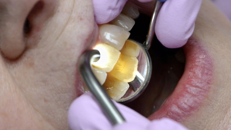 hampaat hammas hammaslääkäri suu hygienia tutkimus terveydenhoito