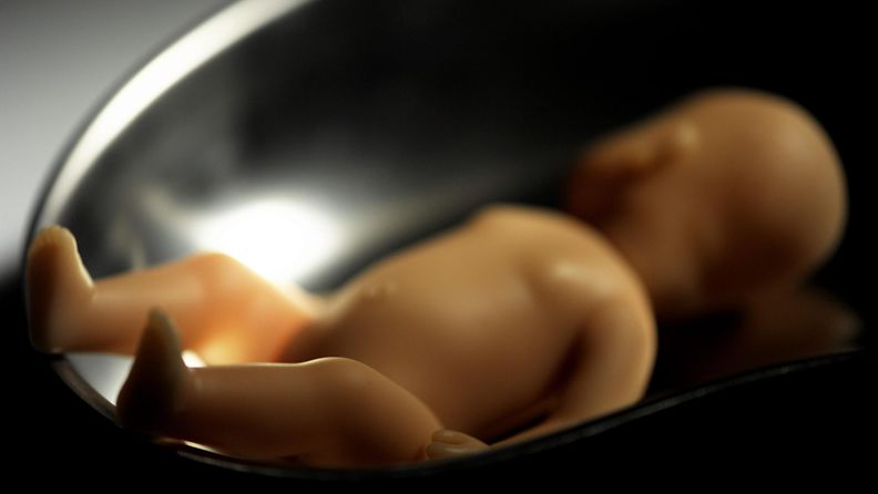 abortti, raskaus