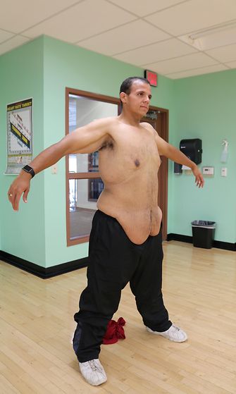 Jesse Shand on laihtunut yli sata kiloa.