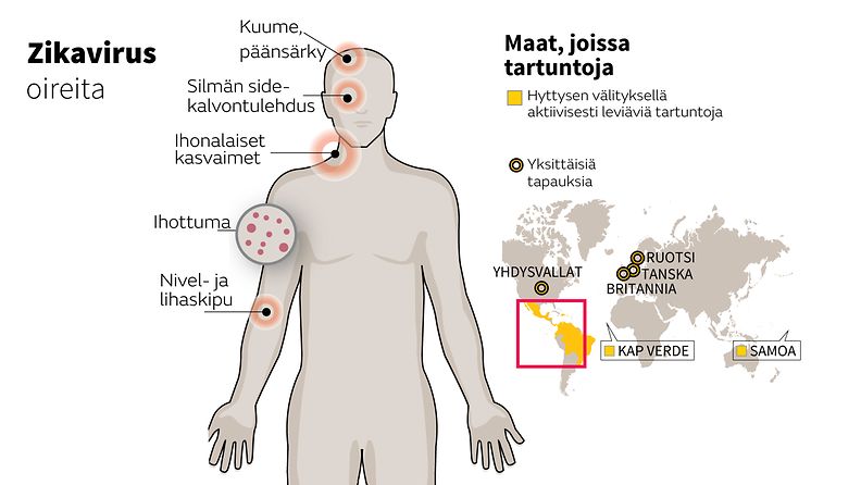 zikavirus oireet