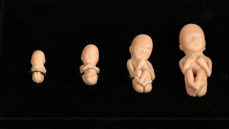 Sikiönuket raskausviikoilta 9, 10, 11 ja 12. Kuvituskuva.