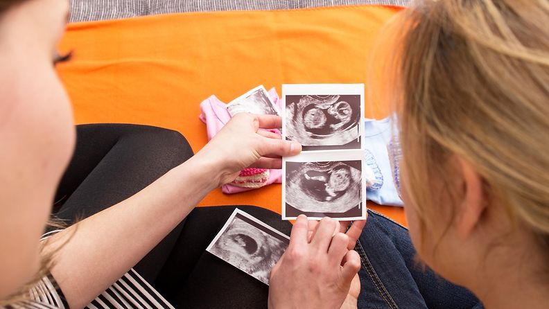 raskaus ultraäänikuva