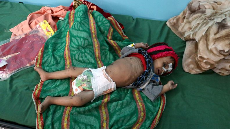 Jemen, nälänhätä