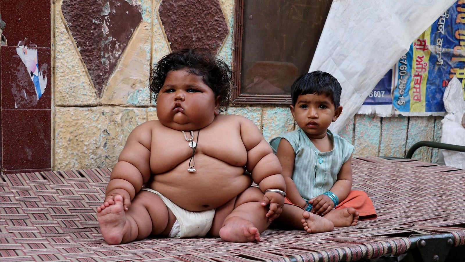Kahdeksankuinen vauva painaa 17 kiloa: 