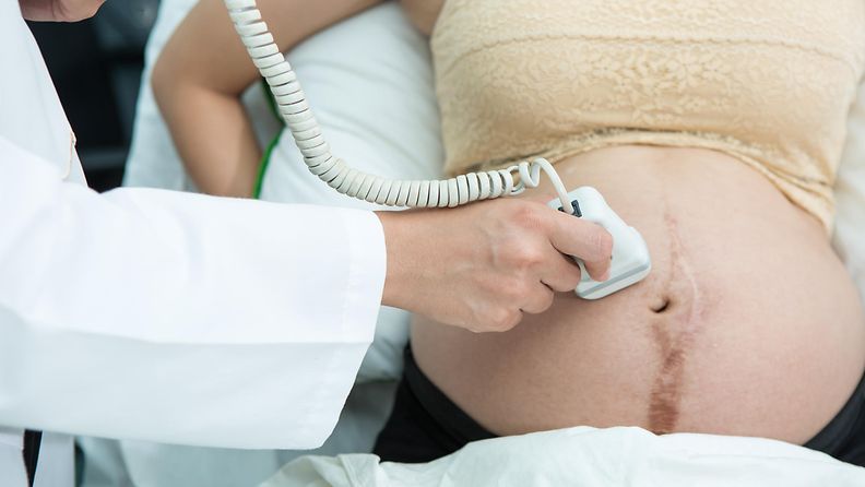 raskaus, ultraääni