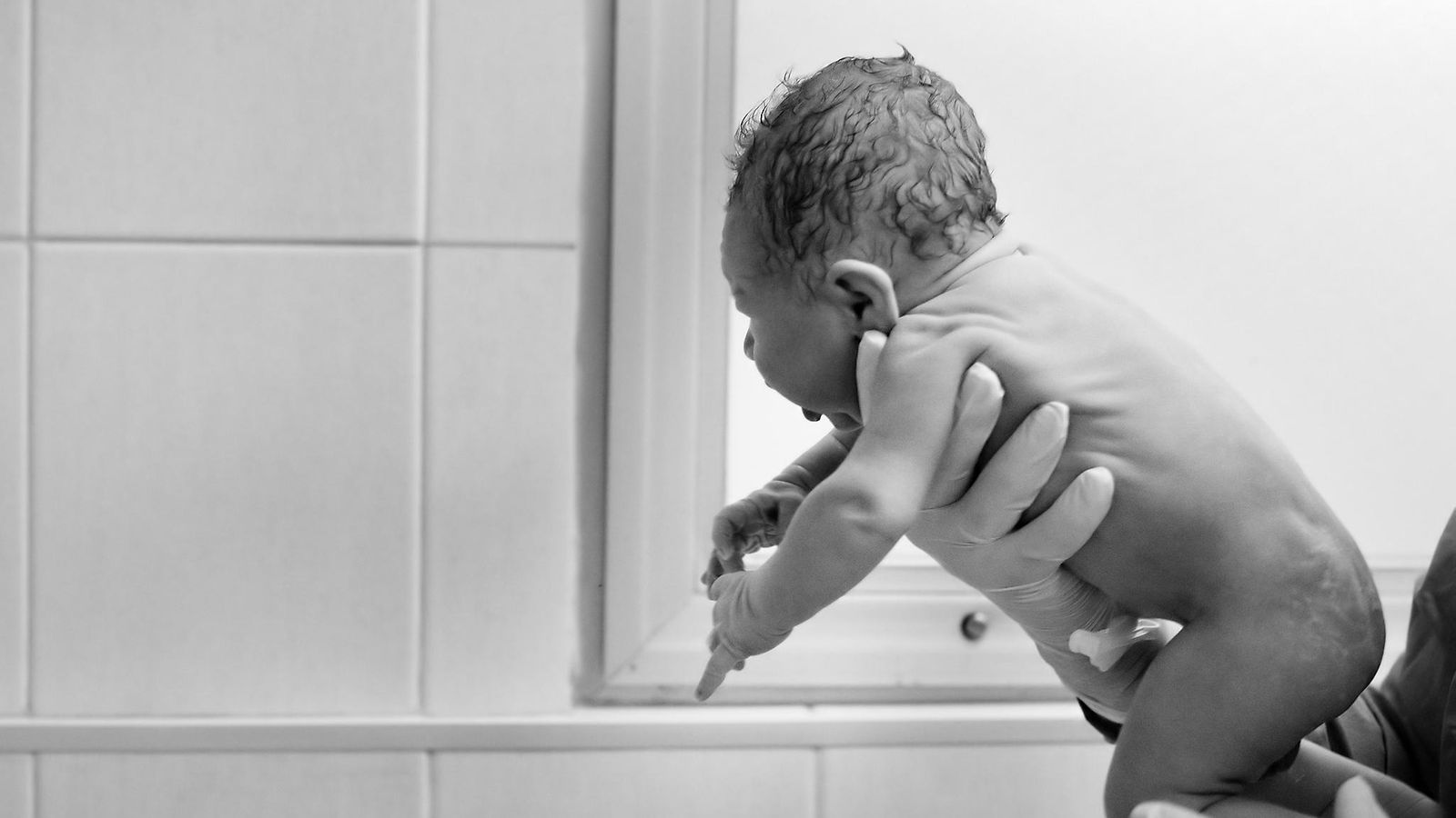 Seta: Intersukupuolisten vauvojen sukuelinkirurgia kiellettävä Suomessa -  