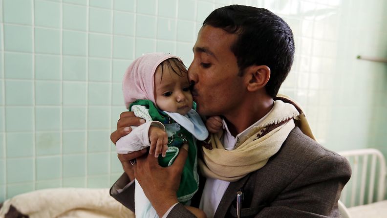 AOP Jemen nälänhätä