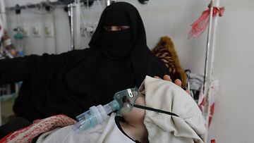 EPA Jemen nälänhätä h_54780318