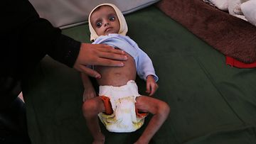 EPA Jemen nälänhätä  h_54780339