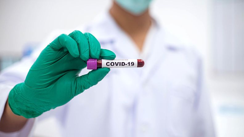 covid 19, koronavirus