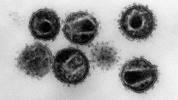 HIV virus mikroskooppi