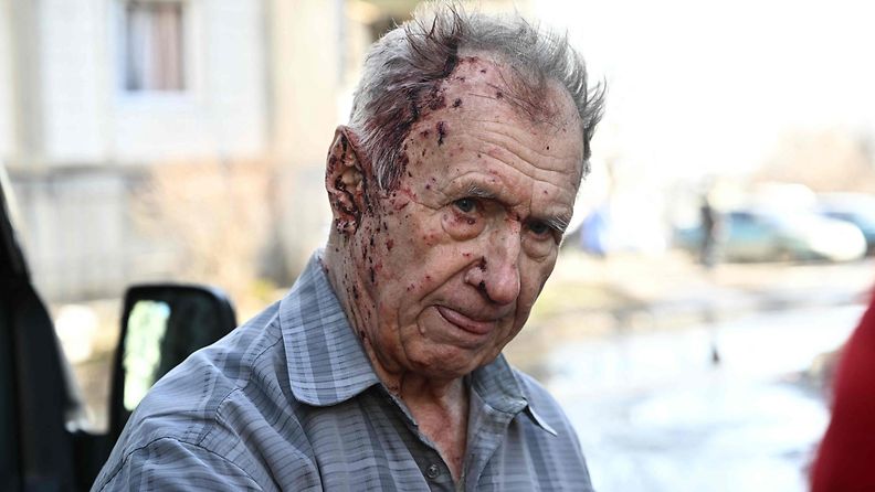 Pommituksessa loukkaantunut mies Tšuhujivissa, Harkovan alueella Itä-Ukrainassa 24. helmikuuta.