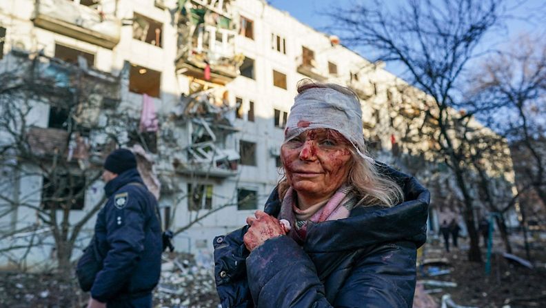 Loukkaantunut nainen ilmaiskussa tuhoutuneen asuinrakennuksen ulkopuolella Tšuhujivissa, Harkovan alueella Itä-Ukrainassa 24. helmikuuta.