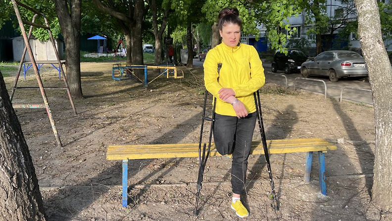 Jalkansa Ukrainassa menettänyt Veronica Tšerevytško.