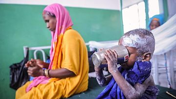 LK 30.3.2023 Aliravittu somalialainen lapsi joi vettä 18. tammikuuta 2018 julkisen sairaalan lastenosastolla, jossa pakolaiset saavat ilmaista lääkärinhoitoa paikallisilta kansalaisjärjestöiltä Mogadishussa Somaliassa.