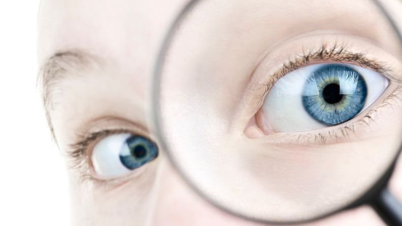 Glaukooma, silmät. silmäsairaudet