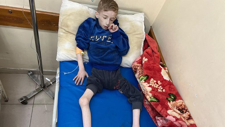 Kuusivuotiasta Fadi Al-Zantia hoidetaan sairaalassa Beit Lahiassa, Gazassa, virtsatietulehduksen ja aliravitsemuksen takia 10. maaliskuuta 2024.
