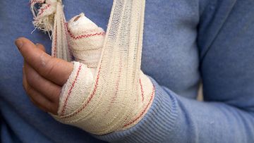 AOP Naisen vasen käsi on sidottu lomalla tapahtuneen murtuman takia. Matkustajia kehotetaan pitämään mukanaan eurooppalaista sairaanhoitokorttia (EHIC) ja hankkimaan matkavakuutus ulkomailla sattuvien tapaturmien varalta.